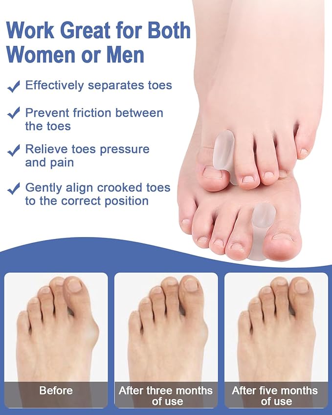 14 Pack Gel Toe Separators Silicone Spacers Soft Bunion Pads for Women Men Foot Pain Relief, Crooked, Overlapping Toes, Hammertoe Corrector(6L+8S)