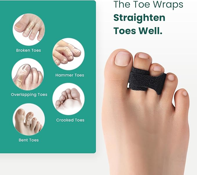 Welnove Hammer Toe Straightener - 8 Pack Broken Toe Wraps - Hammer Toe Corrector for Women - Toe Splints for Crooked Toes, Curled Toes, Bent Toes - (Large, Black)