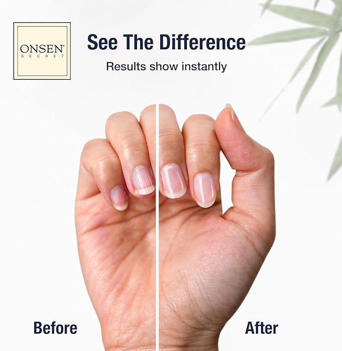 Onsen Secret Ultimate Nail Reboot Kit - Includes Cuticle Oil & Anti Aging Hand Lotion, Professional Nail File and Buffer, 3-Way Block w/Replacement Pads, Nail Strengthening Cuticle Cream