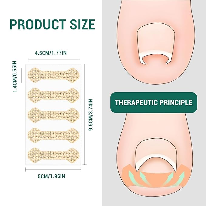 Ingrown Toenail Treatment, 60Pcs Breathable Ingrown Toenail Strips,Painless Ingrown Toenail Tool, Professional Pedicure for Ingrown Toenail, Toenail Corrector Patch