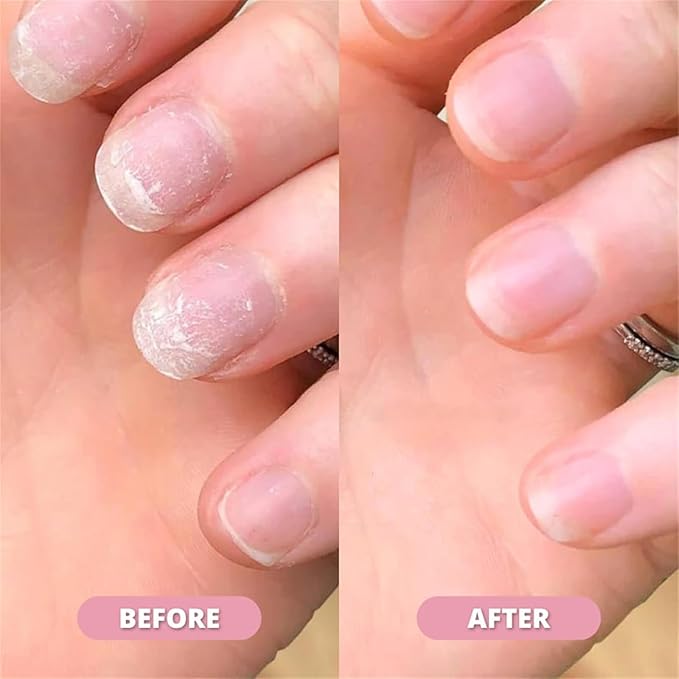 Orville Pen | Cuticle Oil Pen | Nail 𝐆𝐫𝐨𝐰𝐭𝐡 Pen | Nail Growth and Strengthener | Cuticle Oil for Nails | Nail Growth Oils - Strengthen Brittle Nails, Promote Fast Growth (6pcs)