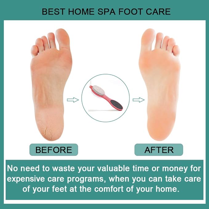 CAREHOOD Foot File Callus Remover - Multi Purpose 4 in 1 Feet Pedicure Tools with Foot Scrubber, Pumice Stone, Foot Rasp and Sand Paper for Home Foot Care (Red Pedicure Foot File)
