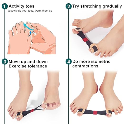 Toe Corrector Toe Separator Bunion Splint 【Updated Version】 Hallux Valgus Big Toes Corrector Set Bunion Brace Bunion Exercise Strap Orthopedic Kit Pain Relief (Blue, free)