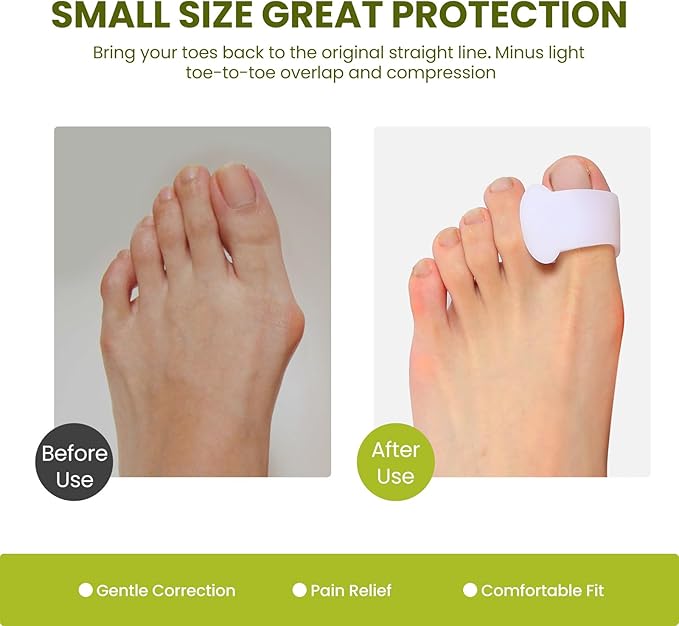 Bukihome Gel Toe Separators for Women -10 Pack Toe Spacers for Overlapping Toes, Bunions, Big Toe Alignment, Bunion Relief - Soft Silicone Toe Corrector for Men (Multi-Size)