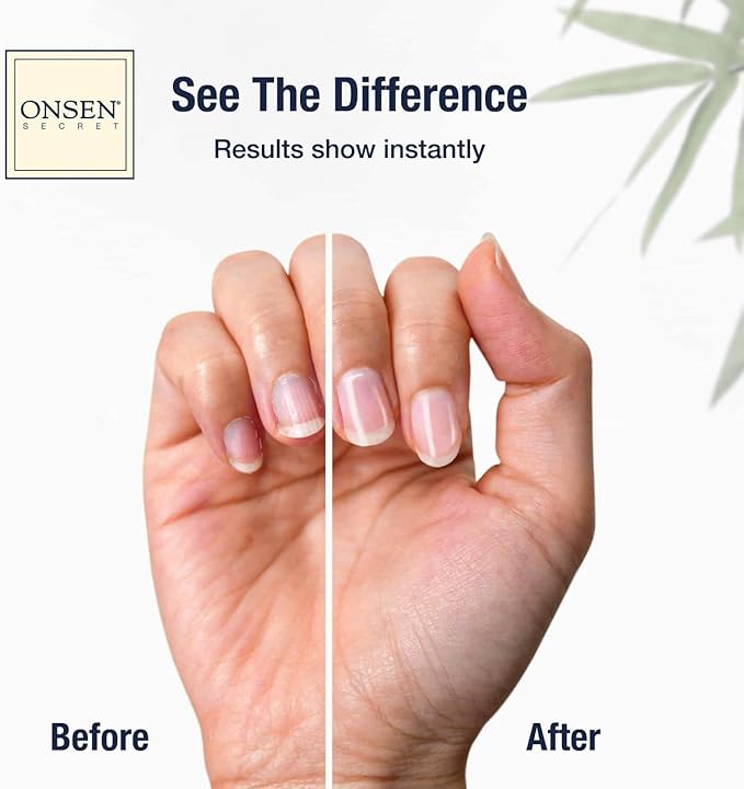 Onsen Secret Nail Care Kit - w/Cuticle Care Serum, Japanese Nail Buffer and Shine Kit - Strengthening & Shining - Spa-Quality Manicure - Organic Ingredients - Long-Lasting Shine - Easy & Safe - 1pk