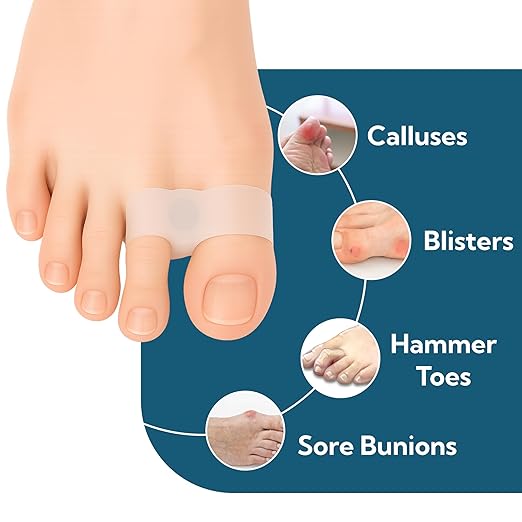 Bunion Spacer with Double Loop – Podiatrist Recommended Silicone Gentle Corrector for Toe Alignment – 8-Pack First Interspace Separator for Hallux Valgus, Overlapping Toes, Hammertoes, Calluses and More – Unisex Gel Support