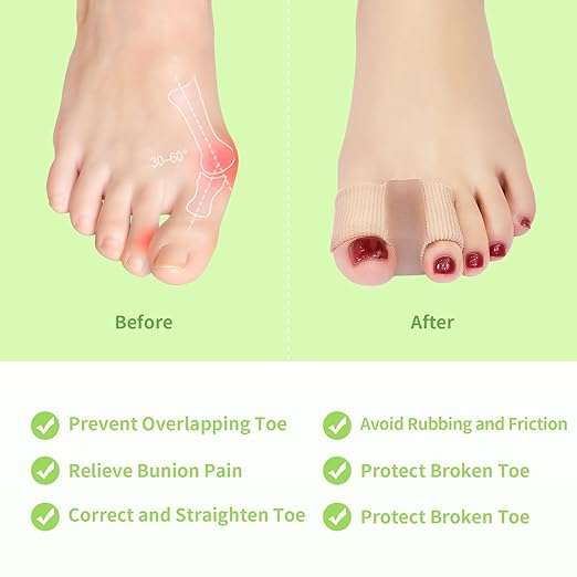 Niupiour Gel Bunion Toe Separators W/Fabric Lining for Big Toe, Silicone Toe Spacers Bunion Correctors for Overlapping Toe, Breathable Toe Corrector Protector for Women and Men, Relieve Foot Pain
