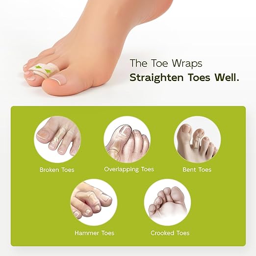 Bukihome Hammertoe Corrector - 10 Pack Toe Straighteners - Broken Toe Wraps - Realign Bent, Curled, Crooked, Claw, Hammer Toes - Toe Corrector Splints for Men and Women (Large, Beige)