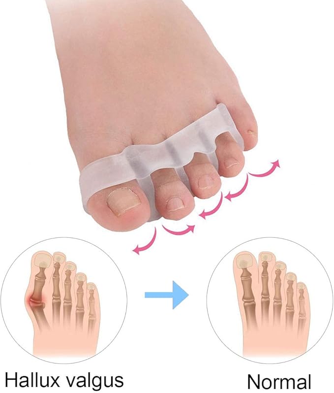 Gel Toe Separator, Toe Straightener for Nail Varnish Reusable Correctors for Overlapping Toes, Bunions, Hammer Toe, Pain Relief Toe Spacers, Pedicure Manicure Nail Art for Men and Women Toe Spreader