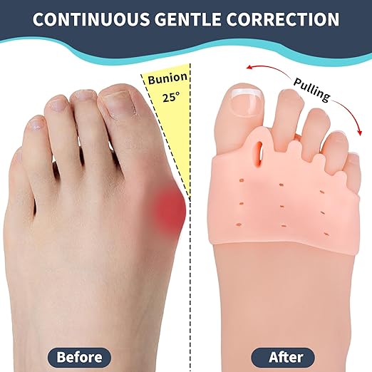 3 Pairs Toe Spacers, Soft and Breathable Gel Toe Separators, Toe Straightener for Hammer Toe, Bunions, Overlapping Toes, Diabetic Feet, Women Men Feet Pain Relief