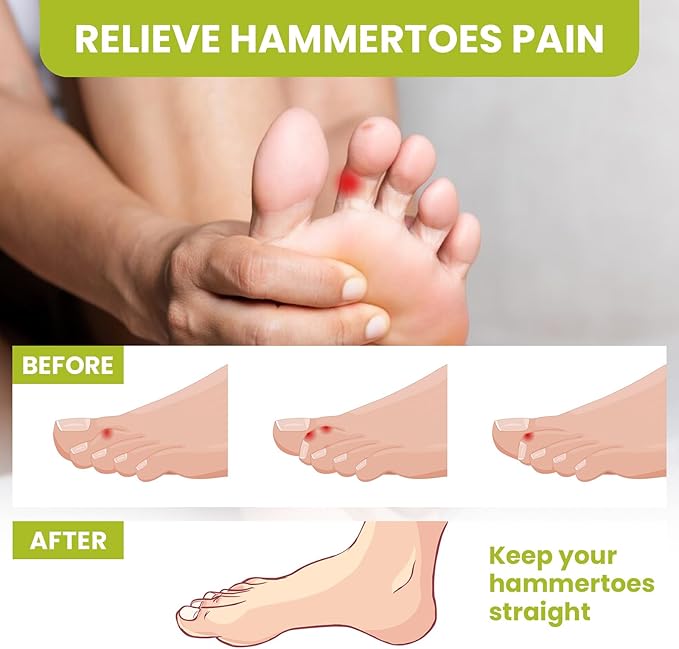 Bukihome Toe Separators, 4 Pair Soft Gel Toe Spacers to Correct Bunions, Toe Stretcher for Therapeutic Relief from Plantar Fasciitis, Foot Pain for Women & Men,White+S