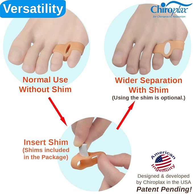 Chiroplax Tailor's Bunion Corrector Pads Bunionette Pain Relief Silicone Pinky Toe Straightener Separator Spacer Sleeve Cushion Splint Protector for Men & Women (4 Pads, Shims - Size Small)