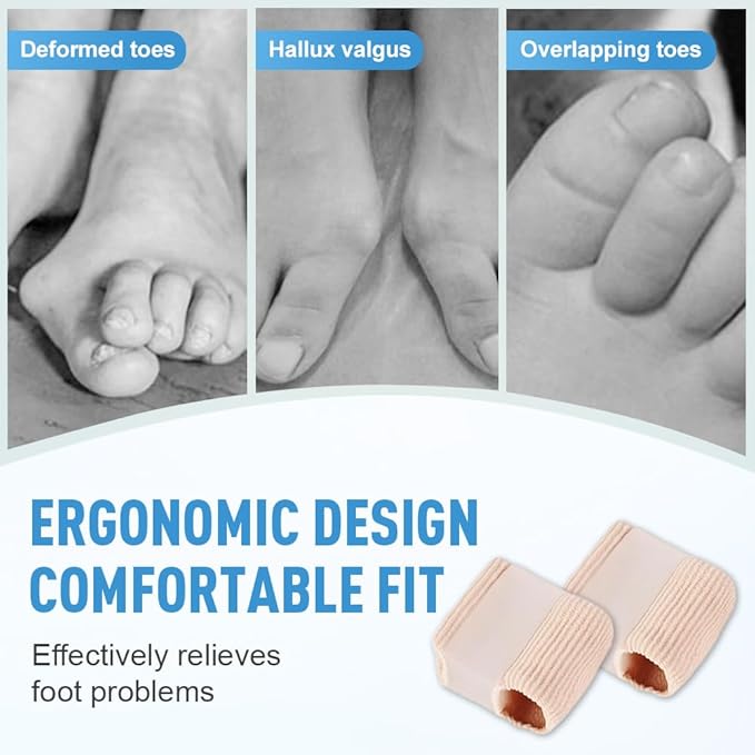 Toe Separators for Overlapping Toes, 2025 New Multifunctional Gel Toe Spacers Corrector with 2 Loops, PremiumToe Straightener for Women and Men Foot Care Tool (12 Pcs, S)