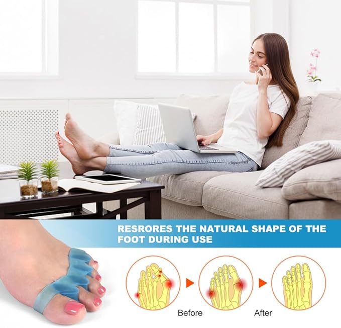 ROOCKE 4 Pcs Gel Toe Spacers for Women,Correct Hammer Toe Bunion Corrector for Men,Big Toe Spreaders,Yoga Toe Separators,Straightener for Overlapping Toes (Blue)