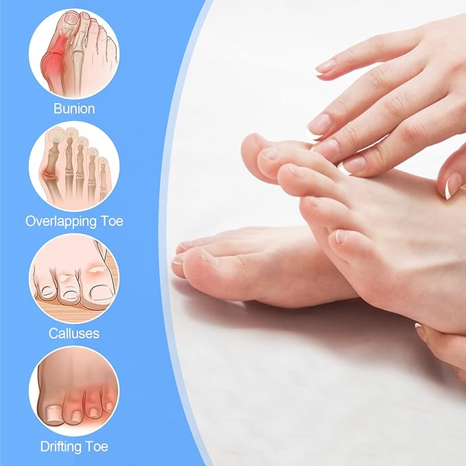12 Pack Toe Separators Bunion Corrector, Big Toe Spacers for Bunions, Hammer Toes, Calluses, Blisters and Relieve Foot Pain (Beige)