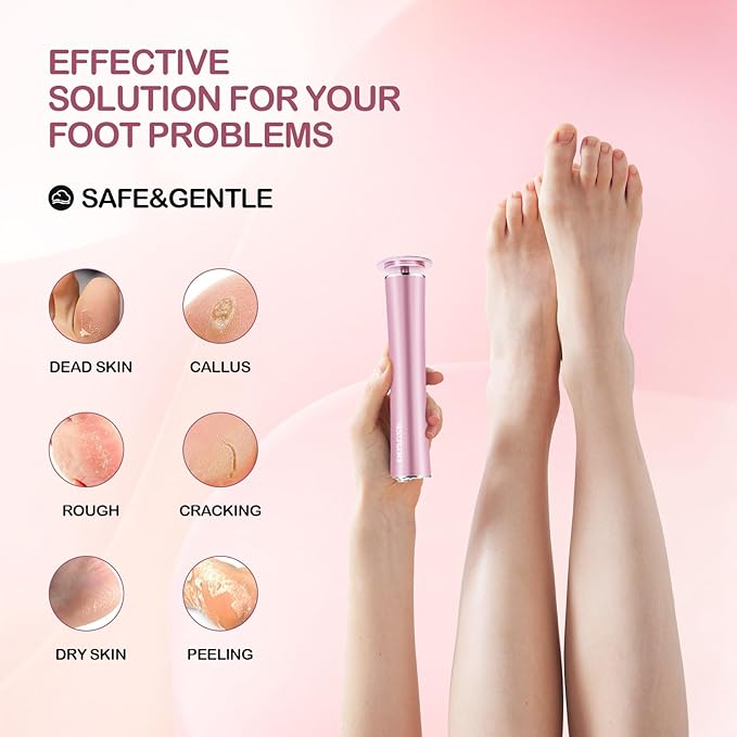 Cordless Electric Foot Callus Remover,Rechargeable Grinder Tool for Feet Dead Skin,Professional Pedicure File Heel Sander with 60pcs Replacement Sandpaper Pads(Pink)