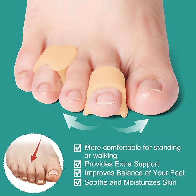 Welnove Gel Toe Separator - 8 Pack Pinky Toe Spacers - Little Toe Cushions, Small Sleeves for Preventing Rubbing & Reducing Pressure (Beige)