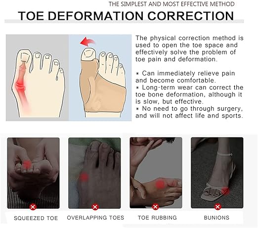 Toe Separator Sleeves, 2 Pairs Soft Breathable Big Toe Corrector with Gel Toe Spacer Cushion, Hammer Toe Overlapping Toes Straightener Sleeves for Big Toe Alignment Bunion Foot Pain Relief (S)