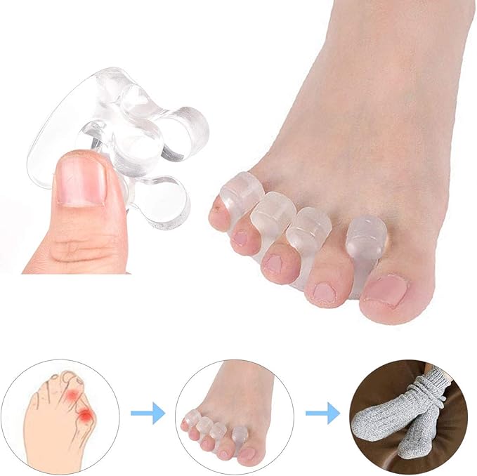 Gel Toe Separators Metatarsal Pads, Breathable Toe Straightener for Overlapping Toes, Bunion Corrector, Hallux Valgus Forefoot Pain Relief, Overlapping Toes, Blisters, Reusable Toe Stretchers
