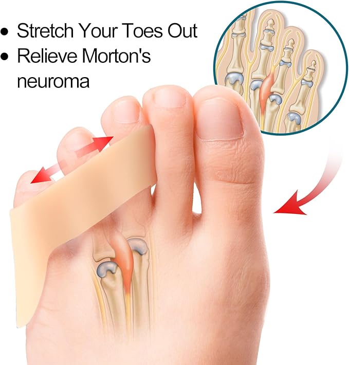 Povihome 10 Pack Pinky Toe Separator and Protectors for Overlapping Toe, Curled Pinky Toes | Spacer for Morton's Neuroma Pain Relief | Firm Support for Straightening | Beige