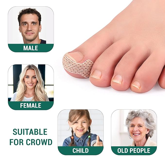 Ingrown Toenail Treatment, 60Pcs Breathable Ingrown Toenail Strips,Painless Ingrown Toenail Tool, Professional Pedicure for Ingrown Toenail, Toenail Corrector Patch