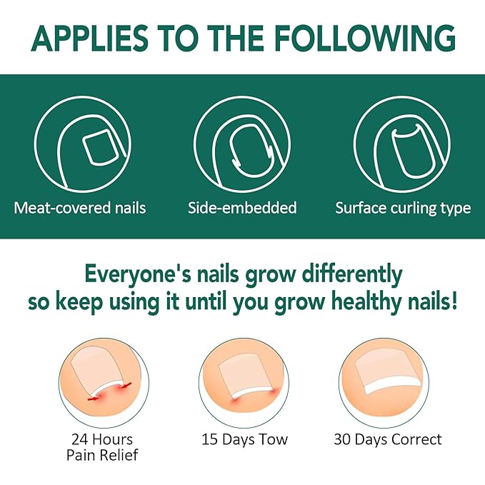 100pcs Ingrown Toenail Treatment, Breathable Ingrown Toenail Strips Ingrown Toenail Stickers, Toenail Corrector Patch with 3 Pedicure Tools for Ingrown Toenail