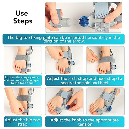 Bunion Corrector for Women Big Toe, Upgraded Adjustable Fix Bunion Relief, Men Big Toe Separator with Soft Gel Pad for Left/Right Feet Fit for All Foot Sizes (Gray 1Pcs)