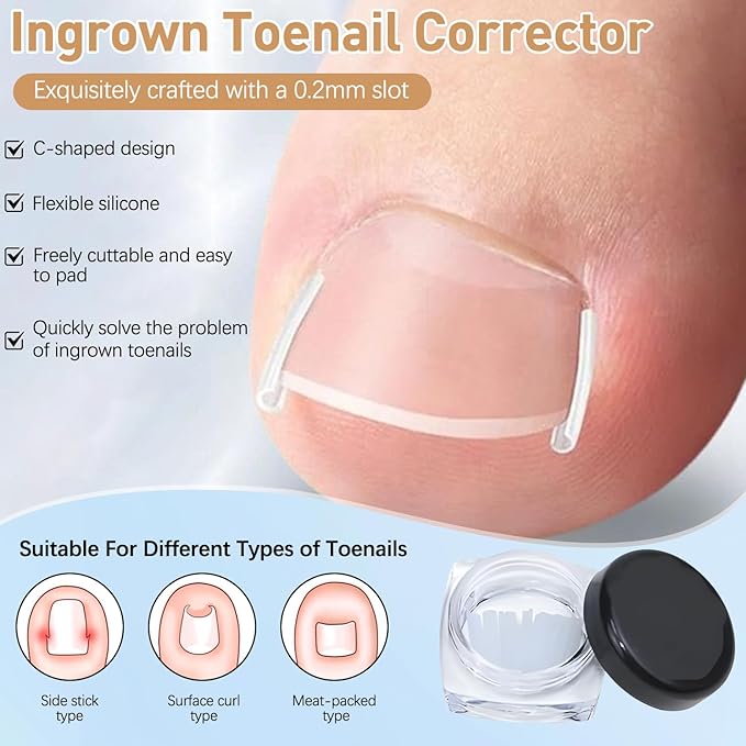 Ingrown Toenail Removal Kit,Professional Toenail Tool Kit Includes Breathable Toenail Strips, Curved Toenails Corrector Patch, Painless File and Lifter Pedicure Tools, Professional Pedicure Tool