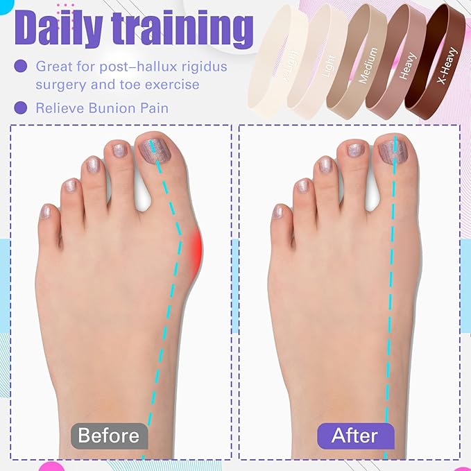 Set of 5 Toe Stretcher Bands for Bunions Correction Foot Big Toe Spacers Resistance Straightener Loop Bands with Carry Bag for Women Men Hallux Valgus Alignment Yoga Exercise(Coffee)