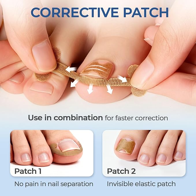 Ingrown Toenail Corrector Set with Correction Strips, Professional Ingrown Toenail Removal Kit Pedicure Tool Set, In Grown Toe Nail Remover Curve Tape at Home for Men Women