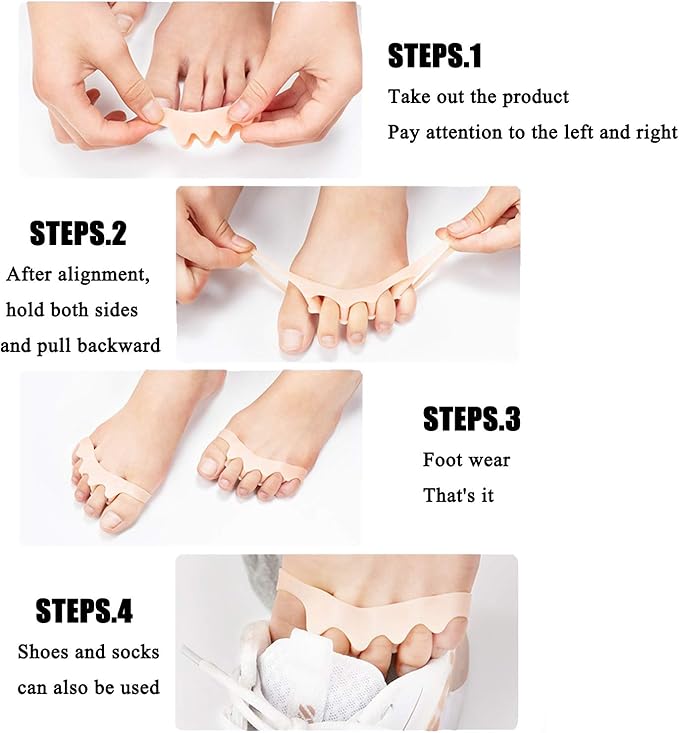 Toe Separators & Spacers,Use for Health & Beauty Pedicures,Plantar Fasciitis, Hammer Toes, Claw Toes & Other Foot Conditions,Pedicures for Kids - White