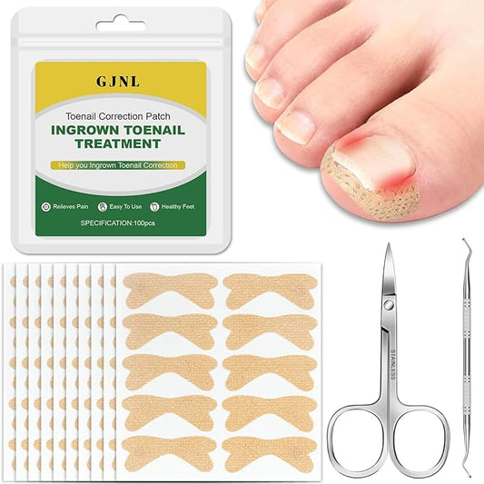 Ingrown Toenail Treatment,100 Pcs Breathable Ingrown Toenail Strips-Toenail Lifter and Small Scissors, Painless Ingrown Toenail Tool, Professional Pedicure for Ingrown Toenail, Toenail Corrector Patch