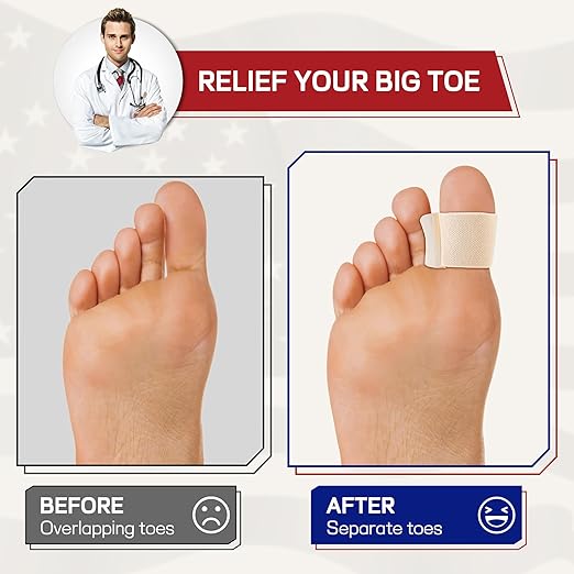 Orthopedic Gel Toe Separators for Overlapping Toes,Big Toe Spacers for Hallux Valgus Corrector with Shock Absorption, All-Day Comfort for Men & Women. (BEIGE, WOMEN(10.5-14)/MEM(9-13))