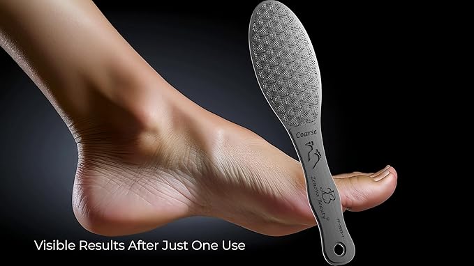 Stainless Steel Foot File with Silicone Grip – Professional Pedicure & Callus Remover, Surgical-Grade Foot Scrubber for Dead Skin & Cracked Heels, Safe for Diabetics, Autoclavable, 2-Year Warranty