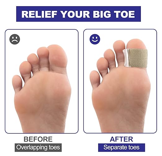 Gel Toe Spacers, Bunion Corrector with Loops(6PC), Portable Toe Separators for Women and Men for Bunion, Overlap Toe, Hammer Toe, Big Toe Alignment