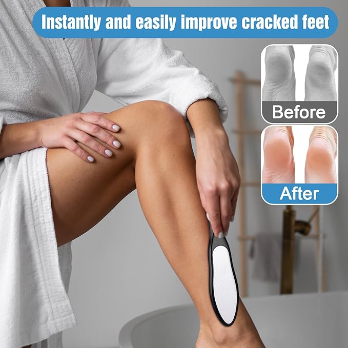 2 Pcs Nano Glass Foot File, Double-Sided Foot Callus Remover,Pedicure Tools for Feet,Wet and Dry Feet Dead Skin Remover, Professional Hard Skin Remover with Non-Slip Ergonomic Handle