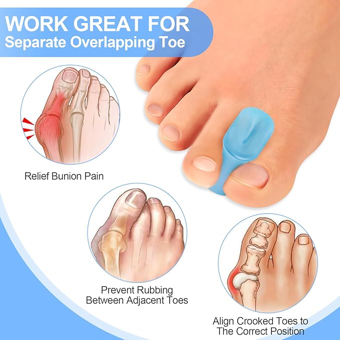 12 Pack Gel Toe Separators, Bunion Toe Spacers for Straightening Overlapping Toes, Hammertoe Corrector, Soft Silicone Bunion Pads for Women Men Toe Pain Relief (Blue)