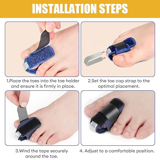 2Pcs Hammer Toe Straightener Corrector for Broken Toe Women & Men, Toe Splints Wraps with Aluminum Plate for Hammer, Curled, Crooked Toes, Pain Relief (Blue)