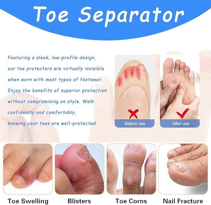 Silicone Anti-Friction Toe Protector, Silicone Toe Protectors, 2024 New Gel Toe Protectors, Breathable Little Toe Covers, Blisters, Calluses, and Corns Protection (30PCS)