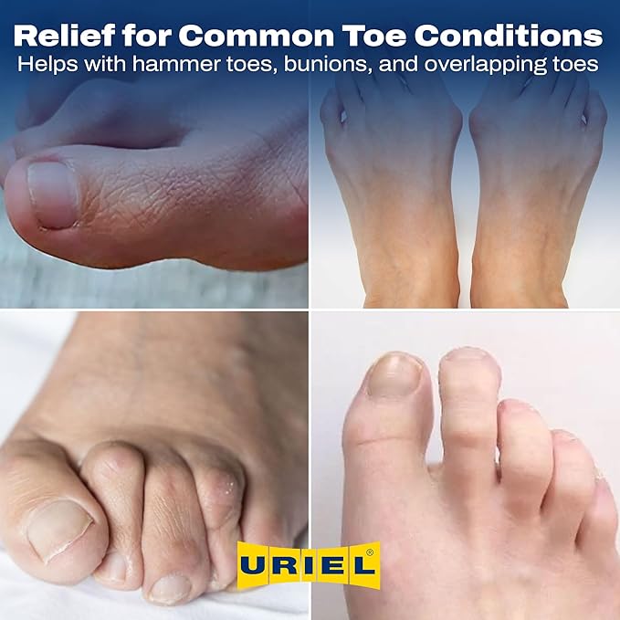 Uriel Silicone Toe Separators for Women & Men – Reusable Toe Spacers for Overlapping Toes, Bunions & Calluses – Soft Non-Slip Design in 2 Sizes for Everyday Comfort, Yoga & Barefoot Use