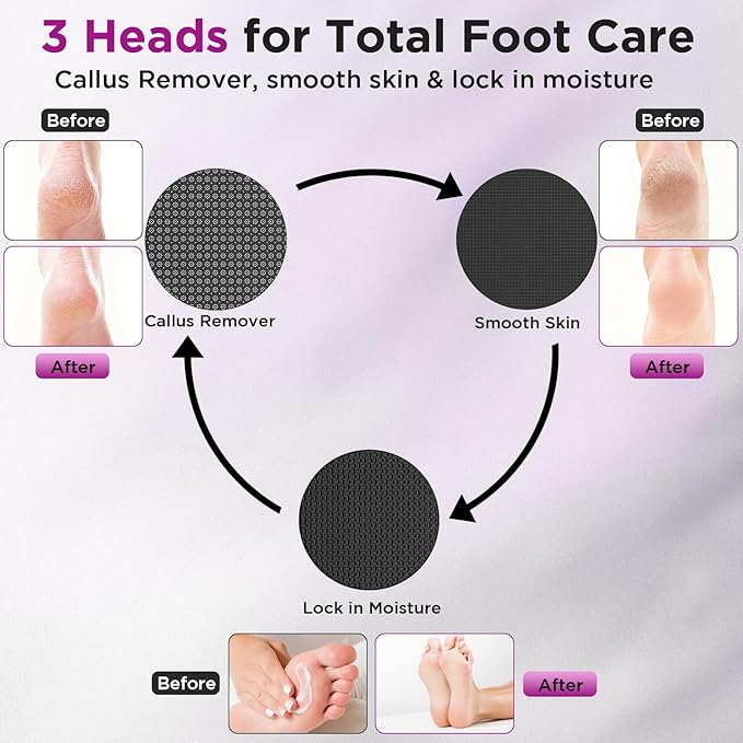 Electric Foot Callus Remover, Apply Oil,Electric Foot File,Reusable Nano-Glass Head, Ergonomic Electric Callus Remover for feet, Rechargeable Pedicure Tools for Feet