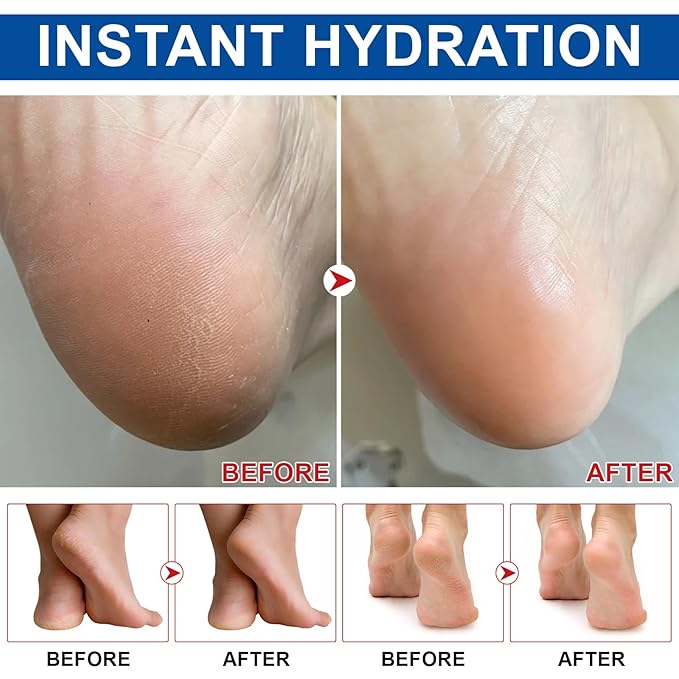 2PCS Urea Cream Stick 60% plus 2% Salicylic Acid, Urea Foot Cream for Dry Cracked Heels, Foot Lotion Stick for Rough Thick Dry & Cracked Skin, Maximum Strength Moisturizer,Foot Moisturiser