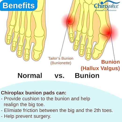 Chiroplax Bunion Corrector for Women & Men Relief Cushion Pads Hallux Valgus Guard Toe Separator Straightener Splint Protector Shield Spacer Sleeve Cover (4 Pads w/Shims, Small)