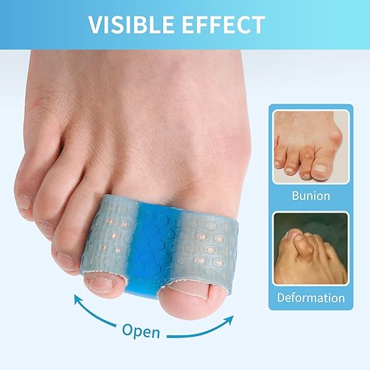 Toe Separator for Women and Men, Bunion Corrector for Big Toe, 4 Pcs Toe Spacer for Bunions, Overlaps, Deformed Toes - Blue Large