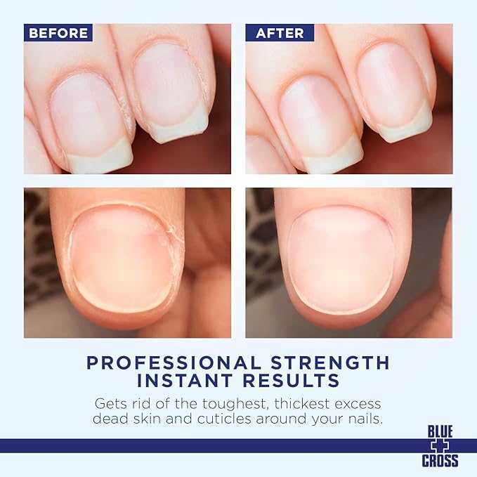Blue Cross Professional Nail Care Cuticle Remover Liquid with Lanolin (6oz) + Yello Out Purple Toner Nail (0.5oz), 2 Pack Bundle