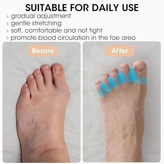 16 PCS Professional Toe Separators, Five - Ring Silicone Toe Spacers, Toe Stretcher Correctors, Ideal for Correct Bunions, Restore Toes Original Shape, Yoga, Pilates or Other Exercises
