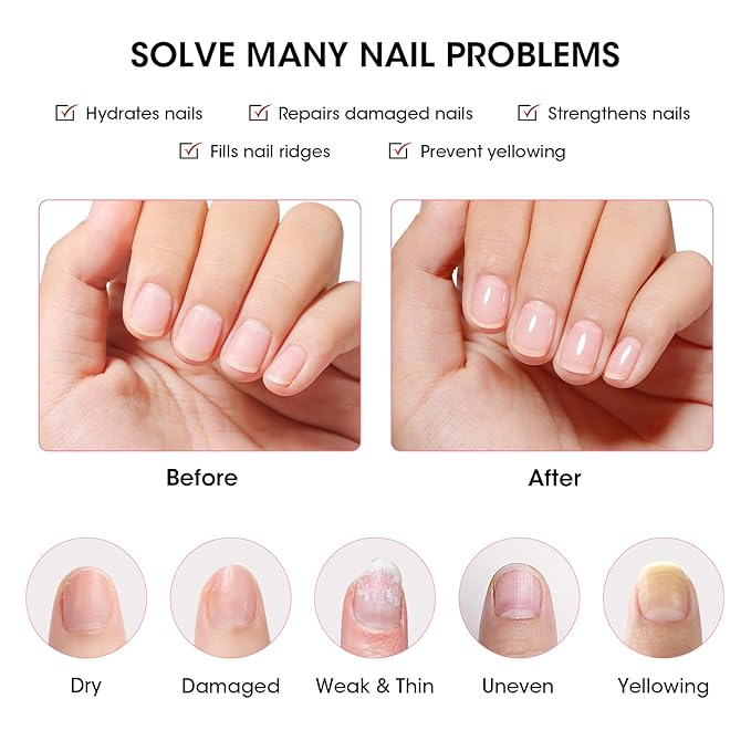 Gellen Tinted Pink Ridge Filler For Nails, Clear Nail Polish Ridge Filling Base Coat, Nail Strengthener and Growth, Hydrates Strengthenes Nourishes Damaged Dry Nails, Shea Butter & Vitamin E & Protein