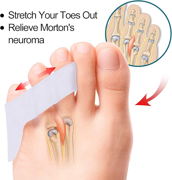 Povihome 10 Pack Pinky Toe Separator and Protectors, Triple Gel Toe Separators for Overlapping Toe, Curled Pinky Toes Separate and Protect