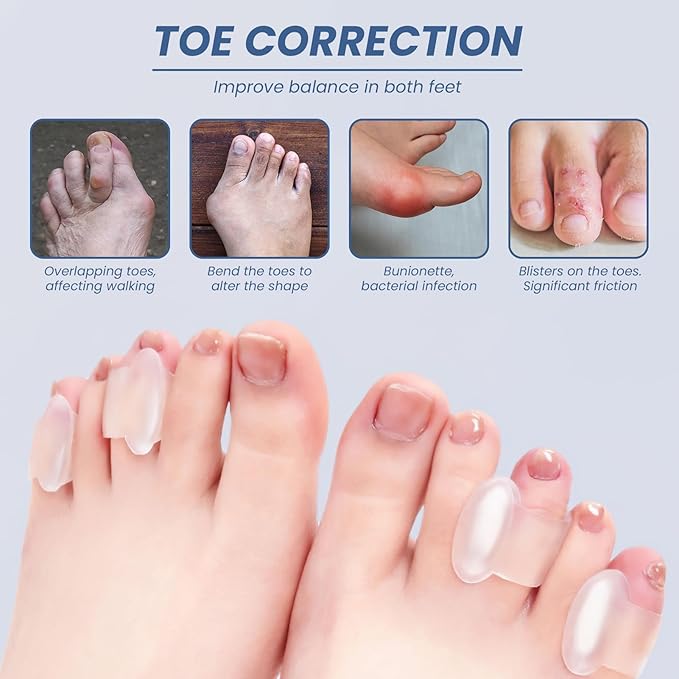 10 Pcs Gel Toe Separator, Pinky Toe Spacers Straightener Bunion Corrector Silicone Toe Separators for Toe Straightening and Relaxation for Women Men Correct Overlapping Toes