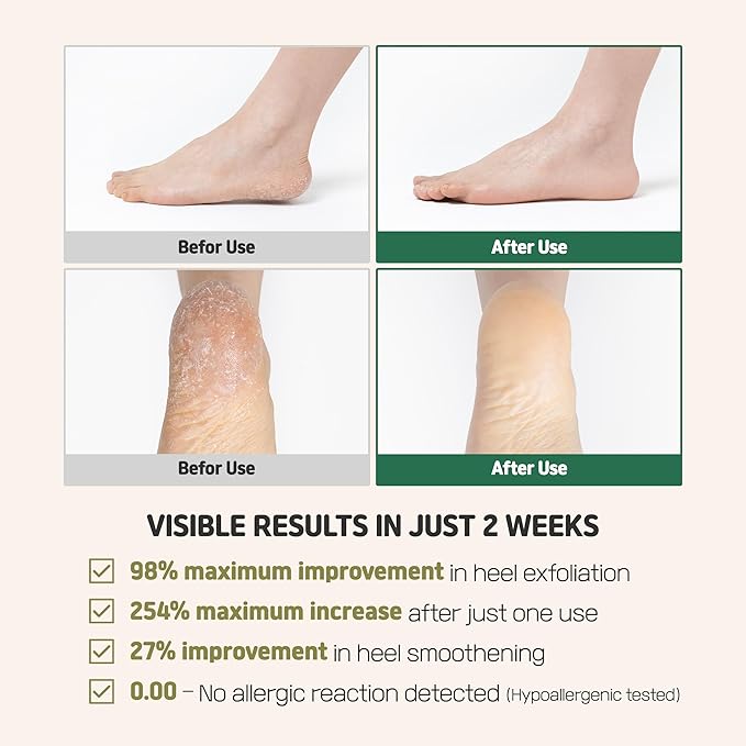 Heartleaf Peelief Foot patch 1box 8ea | Removing Dry, Cracked, and Dead Skin | Peeling Patch | Exfoliant for Peeling Off Calluses | Korean Skincare
